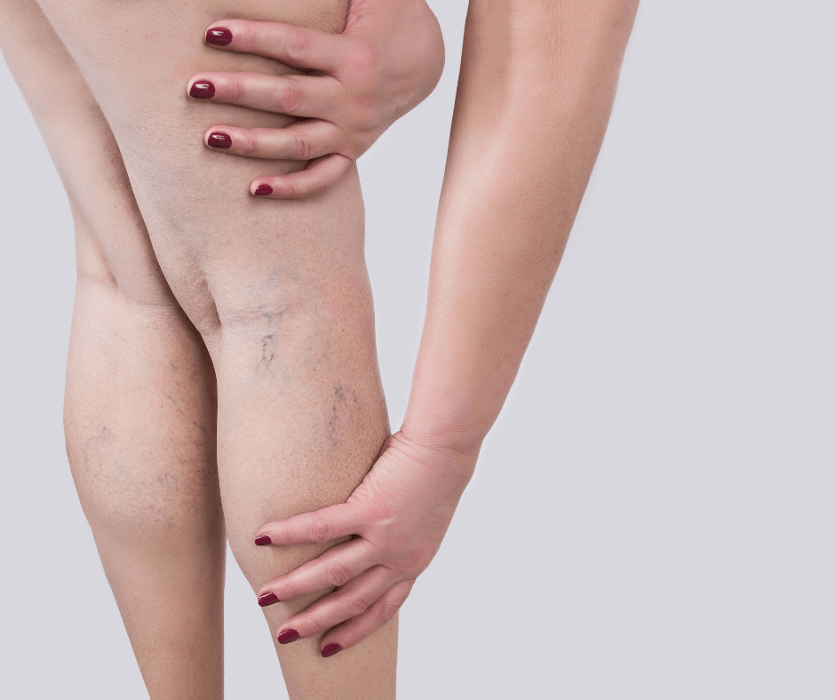 GAMBE-1